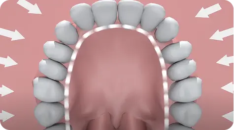 Video 6
