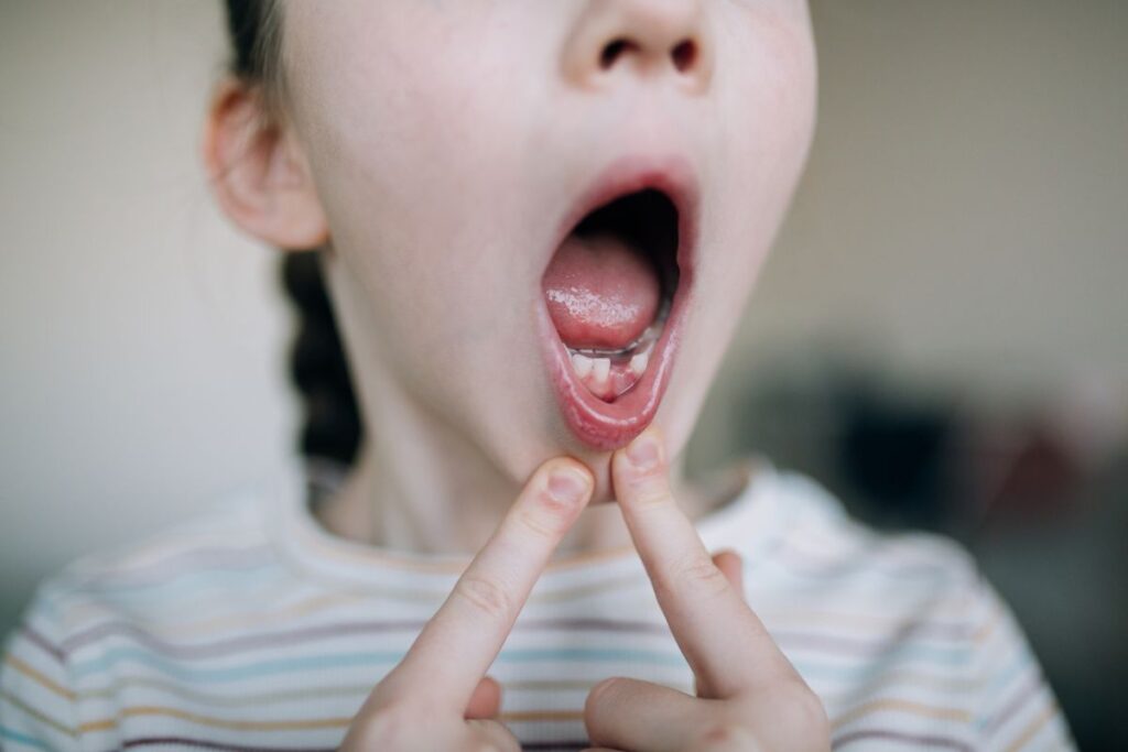 childrenmyofunctionaltherapy TMJ Sleep Therapy Centre Indiana